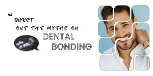 Burst Out the Myths on Dental Bonding